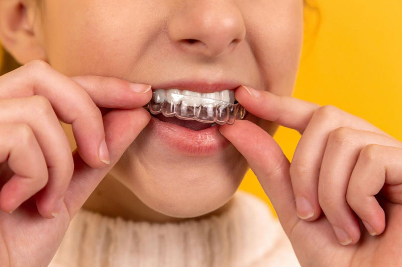 A girl wearing a plastic retainer.