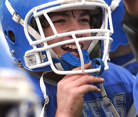 Play With Confidence Wearing Custom Mouthguards