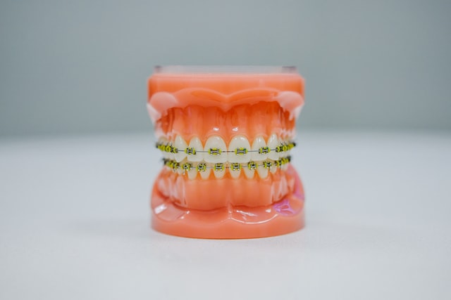 Reproduction of plastic teeth with braces on them.